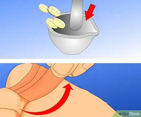 Obrázek nazván Get Rid of Warts Step 13