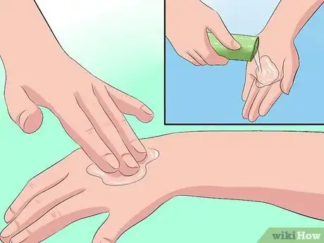 Obrázek nazván Care for Your Aloe Vera Plant Step 10