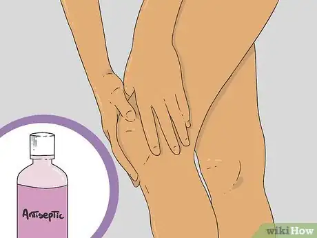 Obrázek nazván Shave Your Legs Step 21