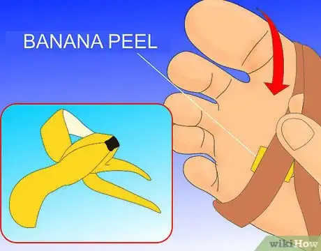 Obrázek nazván Get Rid of a Wart at the Bottom of Your Foot Step 7