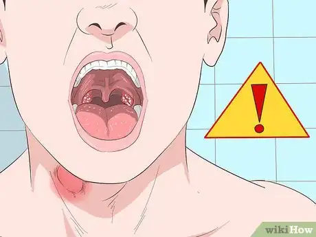 Obrázek nazván Get Rid of a Sore Throat Quickly Step 20